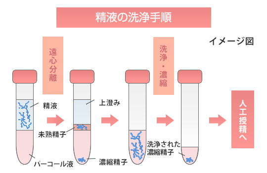 精液の洗浄手順