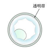 孵化しにくい胚盤胞