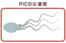 ヒアルロン酸に結合している精子（頭部が止まったまま）
